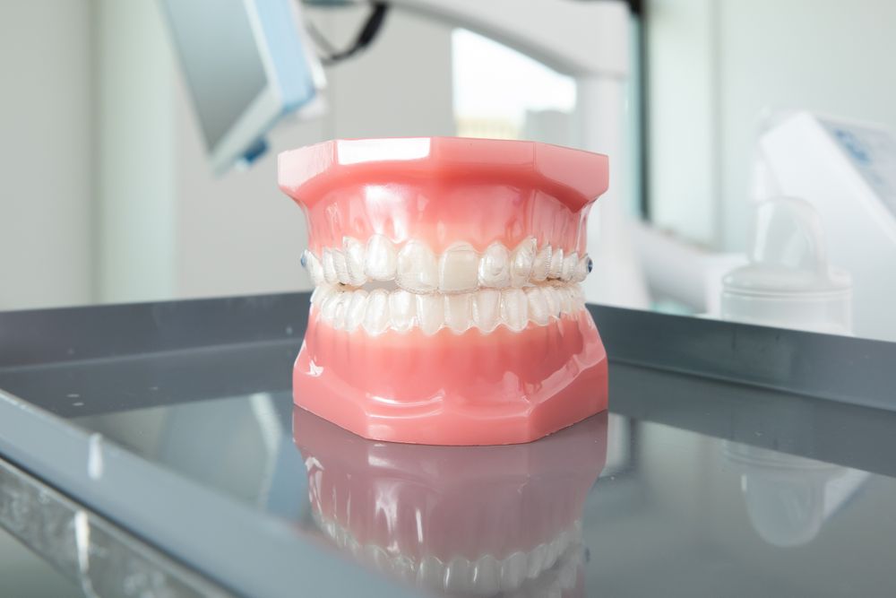 Aligners on crooked teeth - 3Dental Dublin & Limerick